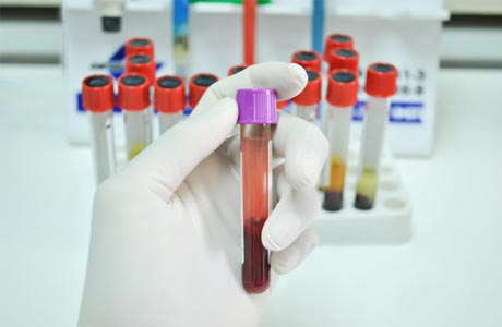 Біохімічний аналіз крові у дорослих: розшифровка, норма в таблиці