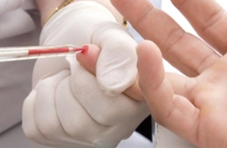 Підвищені базофіли у дорослого: про що це говорить?