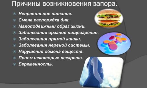 Причини, симптоми і лікування закрепів при геморої