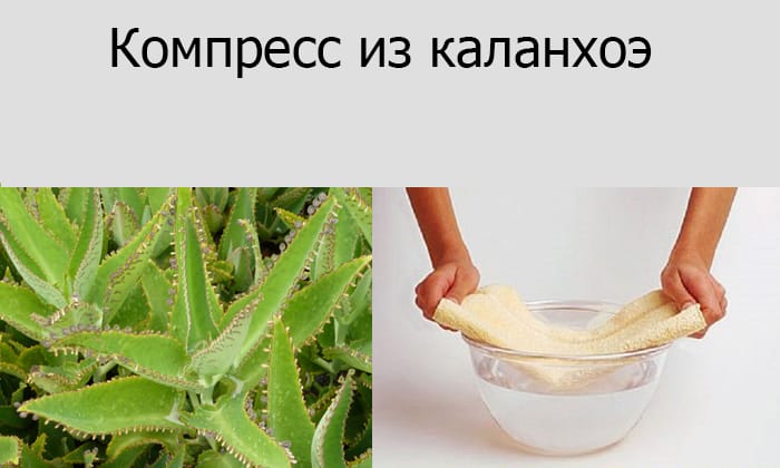 Використання каланхое від геморою