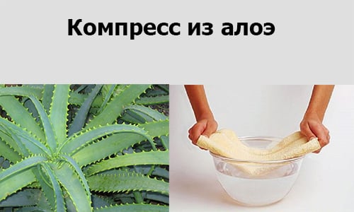 Як алое застосовують при геморої: варіанти лікарських засобів Як алое застосовують при геморої: варіанти лікарських засобів