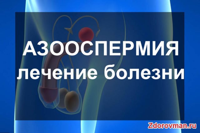 Азооспермія: лікування народними засобами