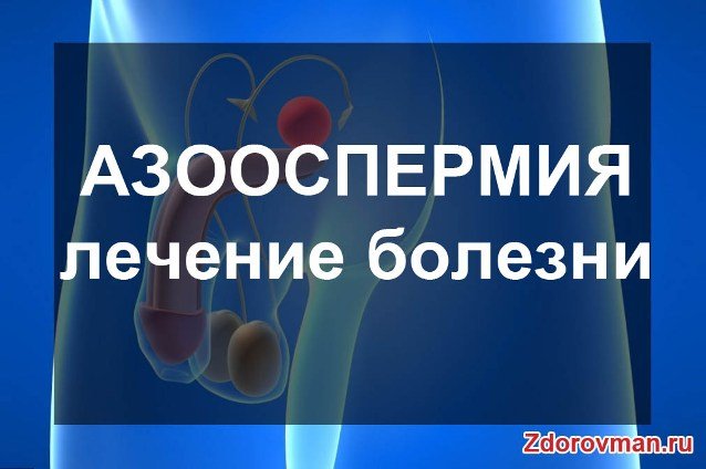 Азооспермія: лікування народними засобами