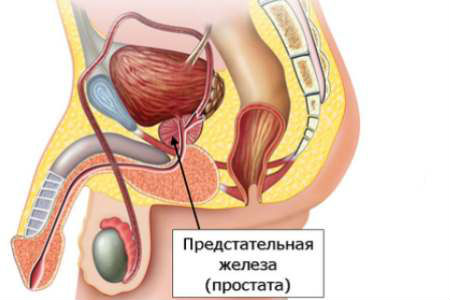 Чим небезпечний цистит – можливі ускладнення і наслідки