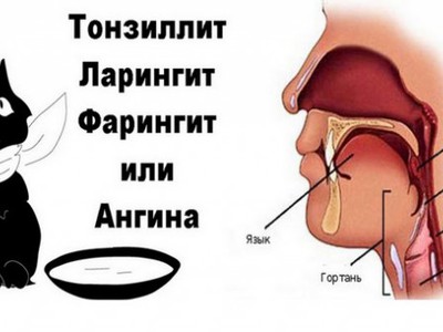 Чим відрізняється ларингіт від фарингіту