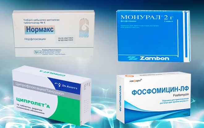 Чим і як лікувати хронічну форму циститу у жінок
