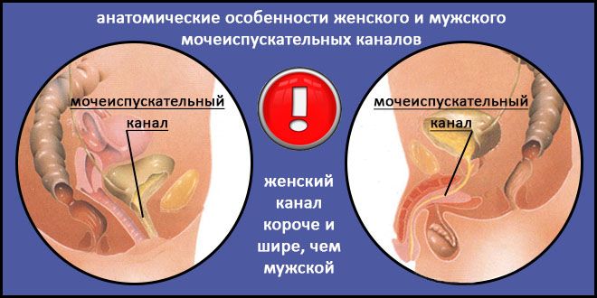 Чим і як лікувати хронічну форму циститу у жінок