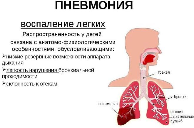 Чим загрожує мокротиння при кашлі і як від неї позбутися