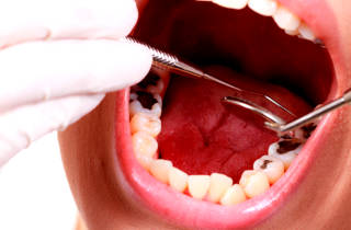 Чому гайморит виникає після видалення зуба