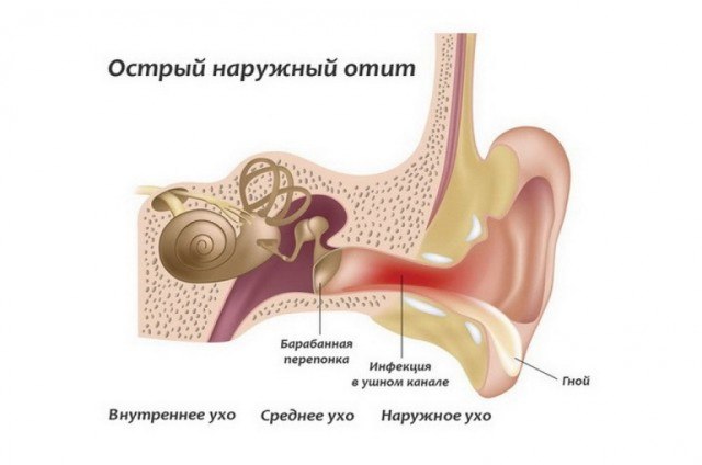 Чому пульсує в вусі і як це лікувати