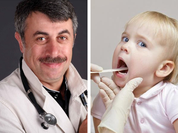 Доктор Е. О. Комаровський – лікування ангіни у дітей 2019