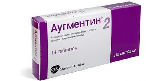 Ефективне лікування фронтита у дорослих