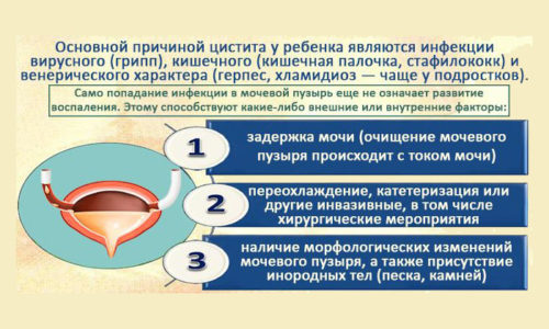 Епітелій в сечі — Яка норма вмісту епітелію в сечі?