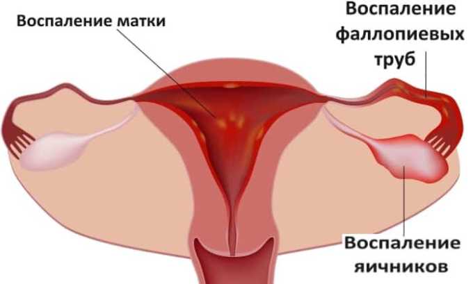 Фурамаг при циститі — інструкція із застосування, протипоказання та відгуки