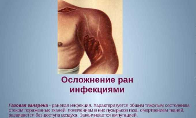 Фурамаг при циститі — інструкція із застосування, протипоказання та відгуки