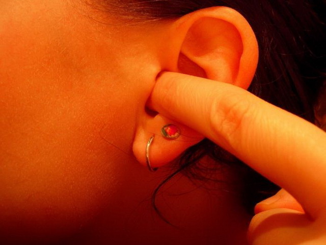 Холестеатома вуха: що це, симптоми, лікування, причини