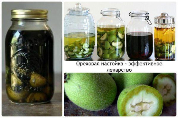 Кіста яєчника лікування без операції – Відгуки про лікування кісти яєчника народними засобами