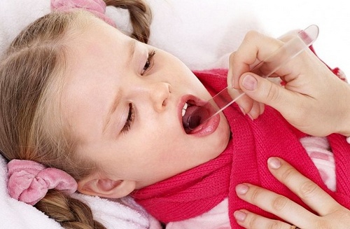 Катаральна ангіна – симптоми і лікування у дорослих і дітей