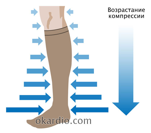 Компресійний трикотаж класи компресійну білизну при варикозі