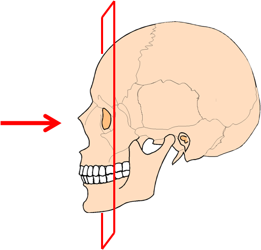 КТ придаткових пазух носа – Комп’ютерна томографія пазух носа