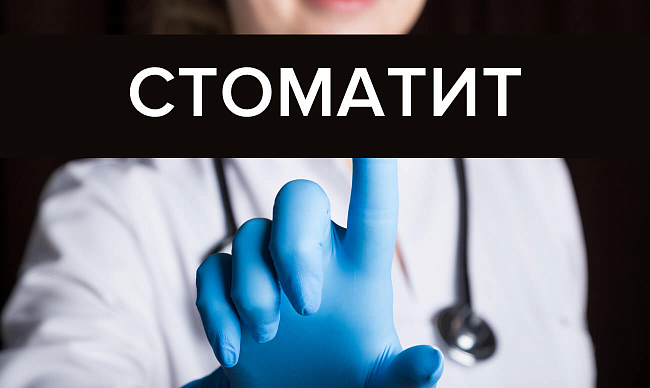 Лікування стоматиту у дорослих в домашніх умовах – фото