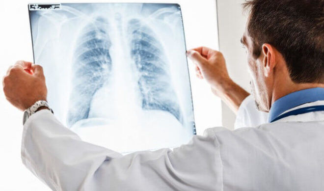 Може пневмонія протікати без симптомів – безсимптомний запалення легенів