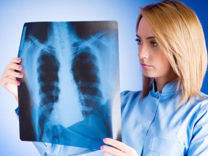 Може пневмонія протікати без симптомів – безсимптомний запалення легенів