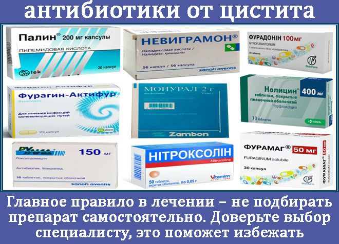 Може початися цистит після прийому антибіотиків