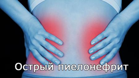 Чим лікувати пієлонефрит нирок: як вилікувати в домашніх умовах, ліки, таблетки