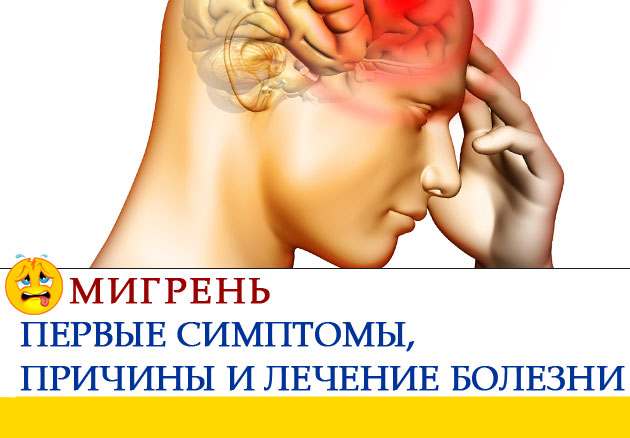 Народні засоби від мігрені швидкого впливу Народні засоби від мігрені швидкого впливу