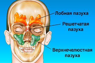 Народне лікування нежиті в домашніх умовах