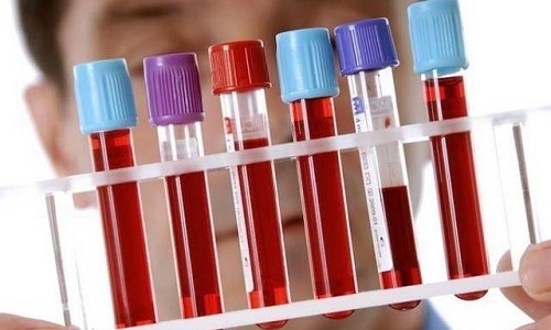 Неприємні відчуття в сечівнику у чоловіків і жінок
