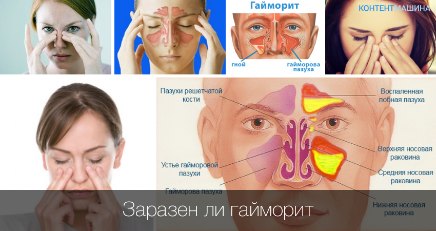 Інструкція по застосуванню Декасана для інгаляцій небулайзером дорослим і дітям