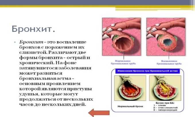 Інструкція щодо застосування препарату Ко-тримоксазол для дорослих і дітей аналоги