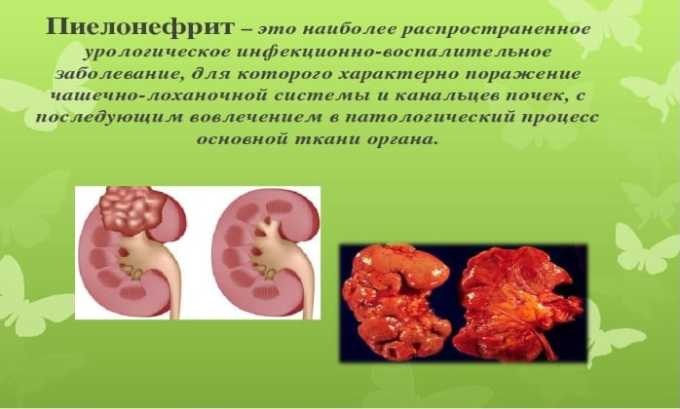 Інструкція щодо застосування препарату Ко-тримоксазол для дорослих і дітей аналоги