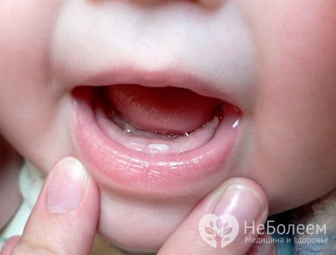 Огляд мікстур для дітей від кашлю суха рідкі сиропи препарати для немовлят до року