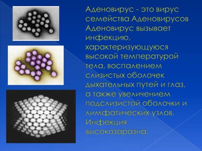 Пітливість при пневмонії у дорослих – як розпізнати, лікування та види