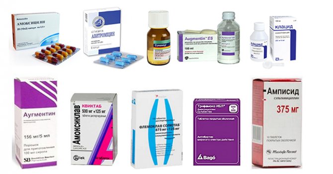 Пітливість при пневмонії у дорослих – як розпізнати, лікування та види