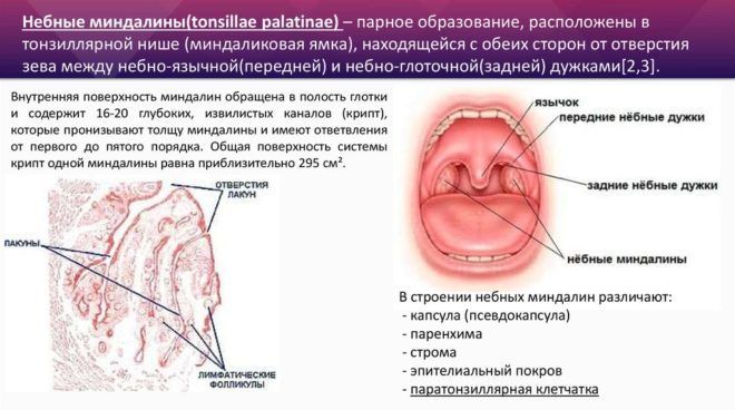 Паратонзіллярний абсцес – симптоми, лікування, ускладнення та наслідки абсцесу