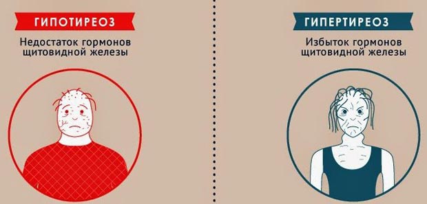 Перші ознаки та симптоми гіпотиреозу у чоловіків методи визначення патології
