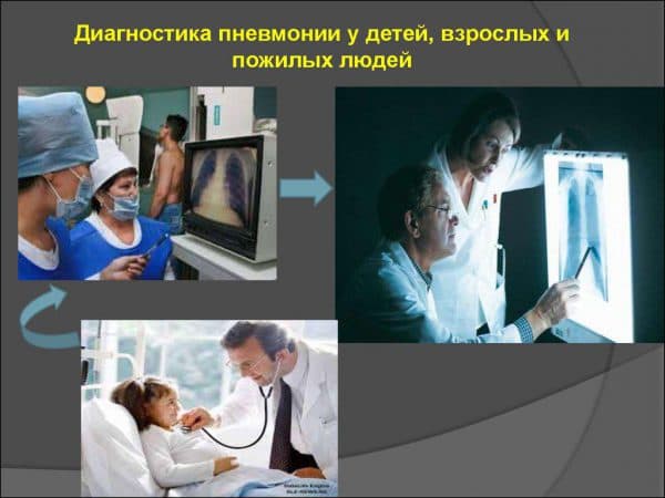 Перші ознаки запалення легенів: як вчасно розпізнати?