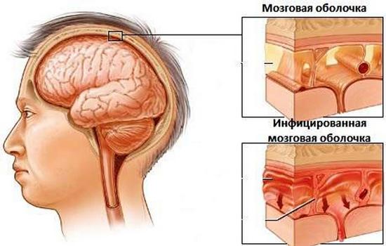 Погіршення нюху і зміна сприйняття запахів