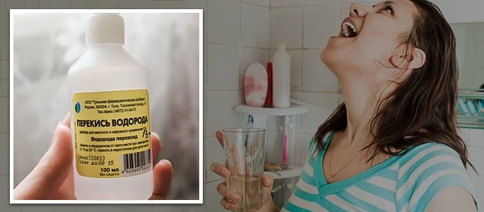 Полоскання горла перекисом водню при ангіні