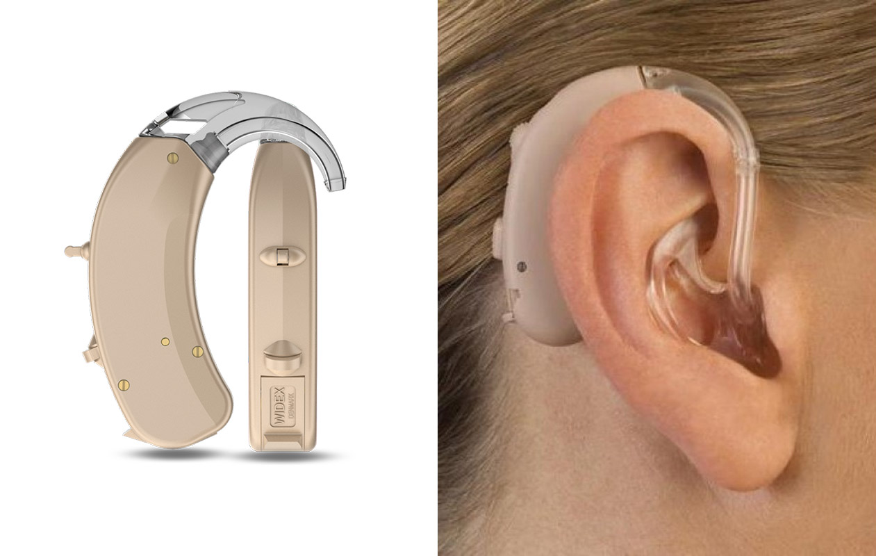 Поради та рекомендації щодо вибору слухового апарату
