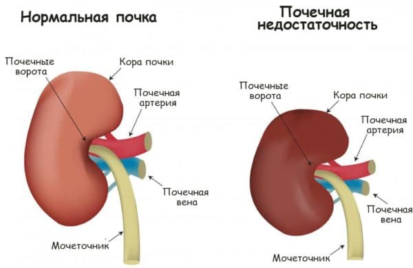 Препарат Омнитус для лікування кашлю у дітей і дорослих