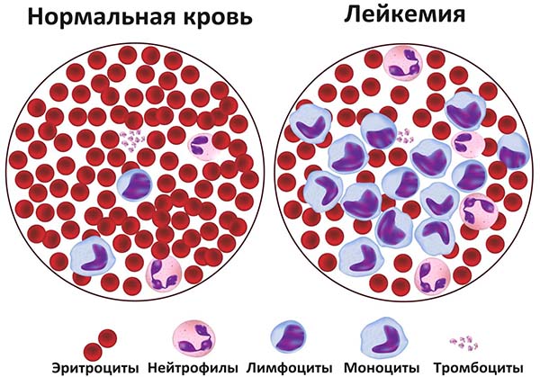 Причини і лікування збільшених потиличних лімфовузлів у дітей і дорослих