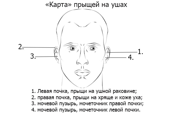 Причини появи прища у вусі