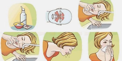промивати ніс розчином чи можна промивати ніс дитині