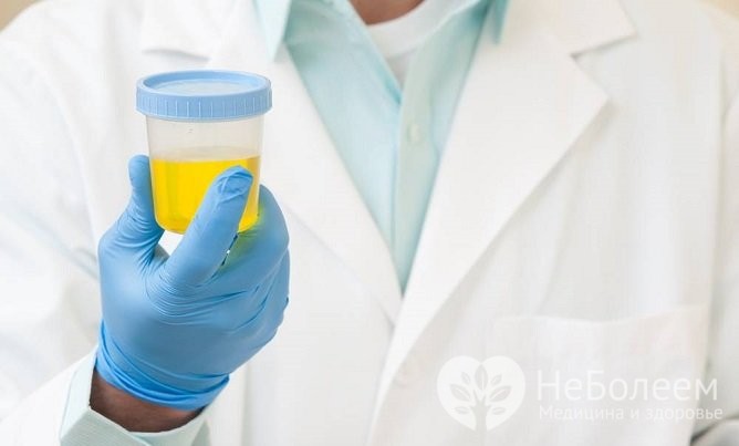 Рекомендації по збиранню і здачі сечі за методом Нечипоренко