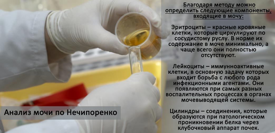 Рекомендації по збиранню і здачі сечі за методом Нечипоренко